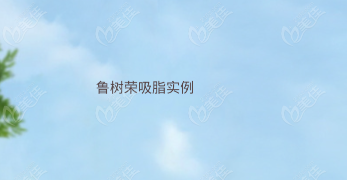 鲁树荣吸脂实例