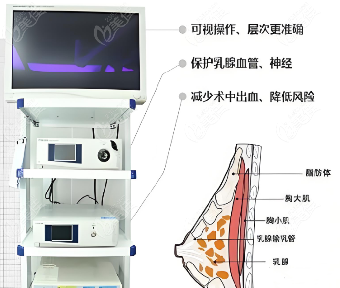 用内窥镜技术取出胸部捷克水分子靠谱
