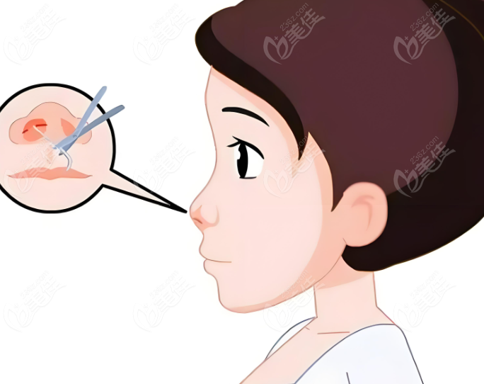 杭州薇琳温科磊做鼻子多少年了？