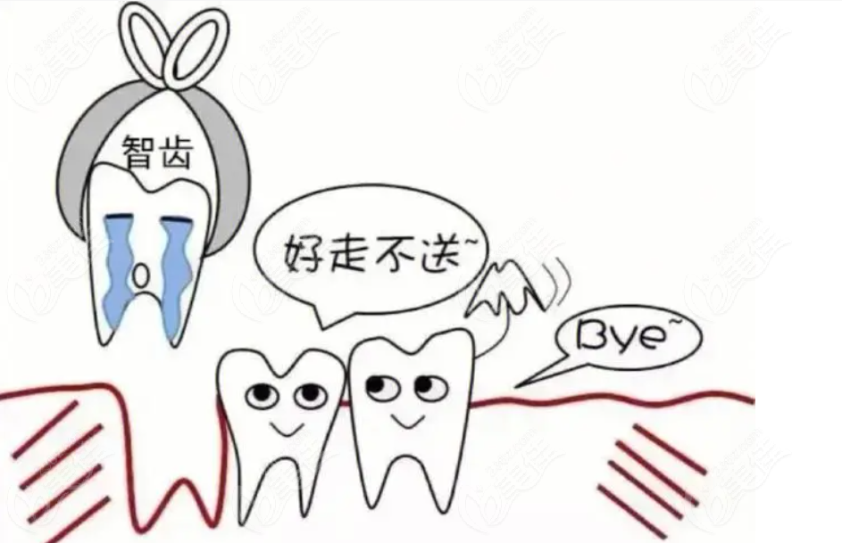 拔牙注意事项