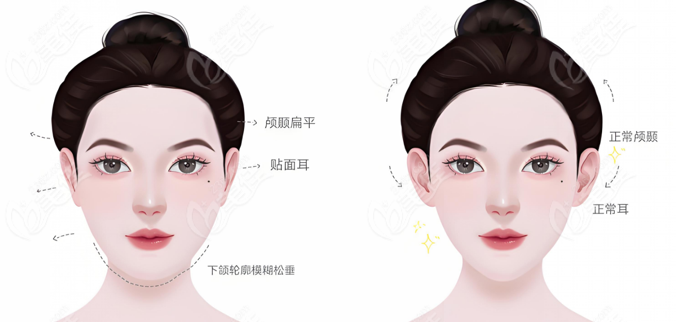  李俊霞打针塑造幼态脸技术靠谱