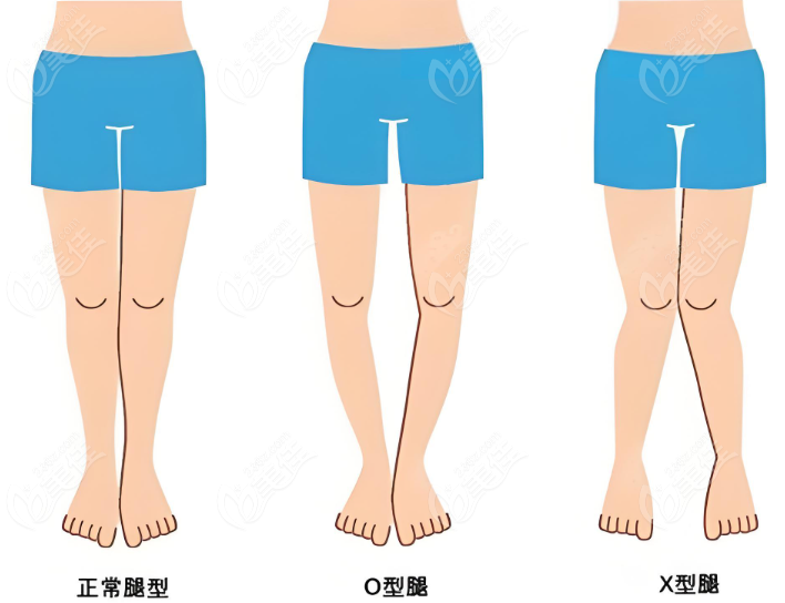 北京自然腿型医院排名前十名单