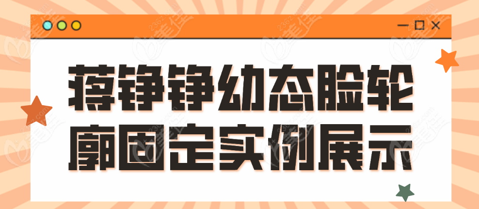 蒋铮铮幼态脸轮廓固定实例