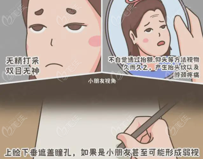 上眼瞼下垂