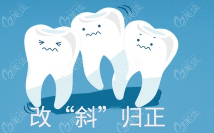 牙齿矫正技术的好处236z.com