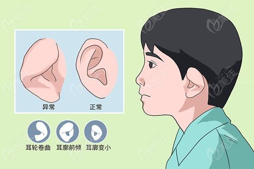 小耳畸形新农合可以报销吗