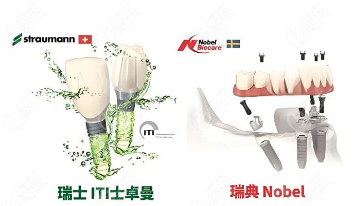 瑞士种植牙iti和诺贝尔nobel植体