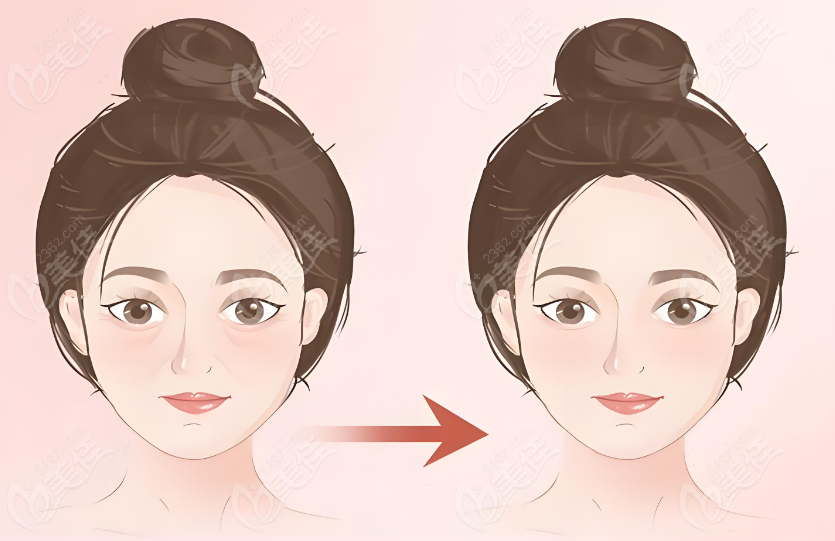 吴贞跃医生馒化脸修复怎么样？