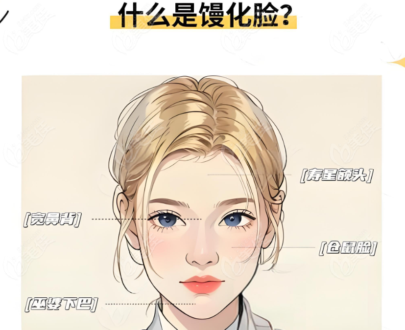 什么是馒化脸