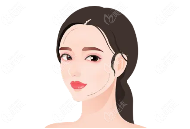 吴贞跃医生手术实例www.236z.com