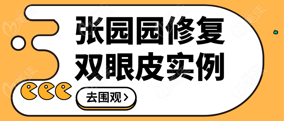 <!--<i data=20240703-sp></i>-->修复双眼皮实例