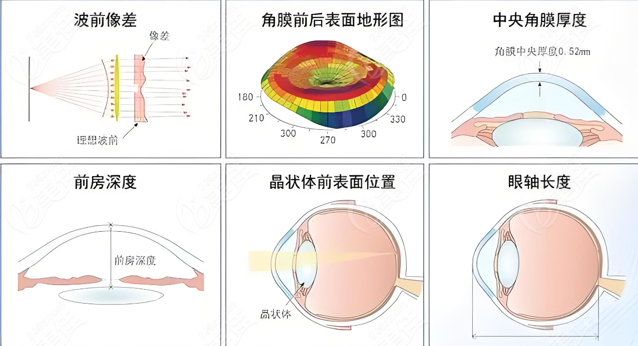 全光塑矫正视力成效明显