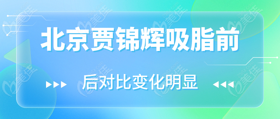 北京贾锦辉吸脂前后对比变化明显