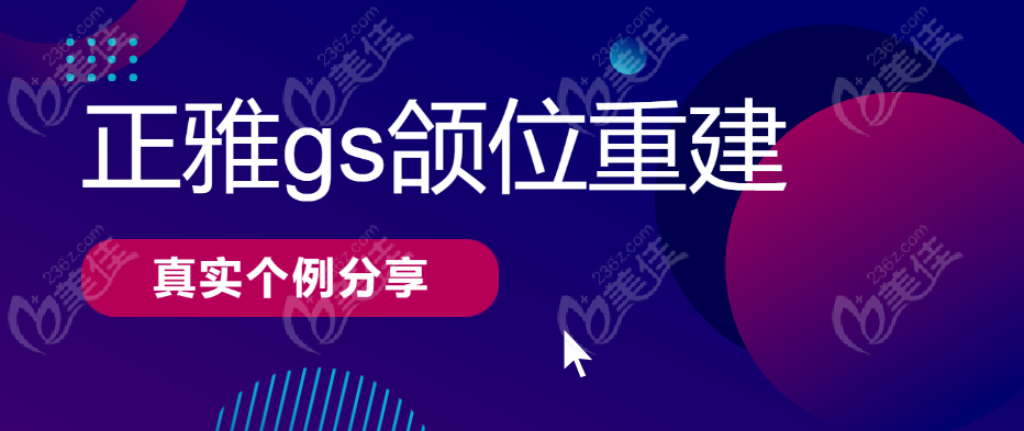 正雅GS颌位重建病例