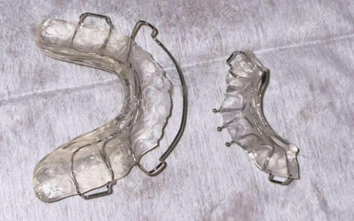 隐适美下颌前导矫正