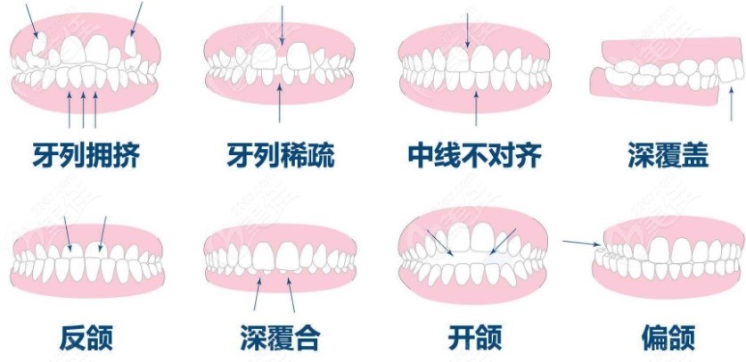 青岛哪家医院矫正牙齿比较好
