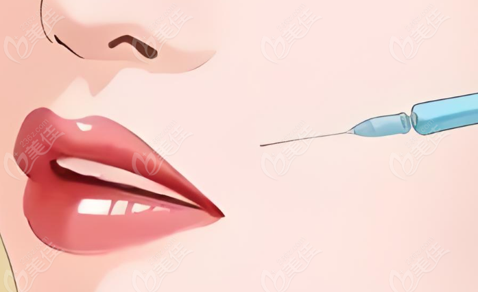 杭州口周年轻化哪个医生好？