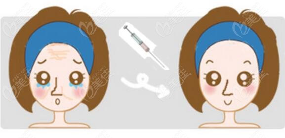 大連玻尿酸填充淚溝醫(yī)院排名前十