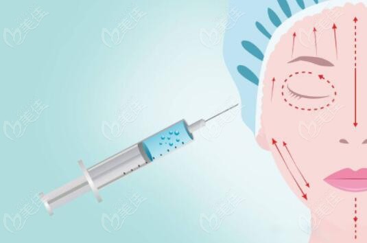 西安玻尿酸轮廓固定谁做的好