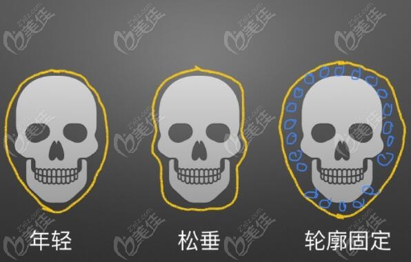 西安玻尿酸填充轮廓固定好医生名单