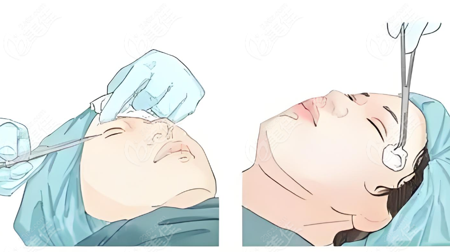北京雙眼皮修復比較好價格便宜的醫(yī)生名單介紹m.xqnp.cn