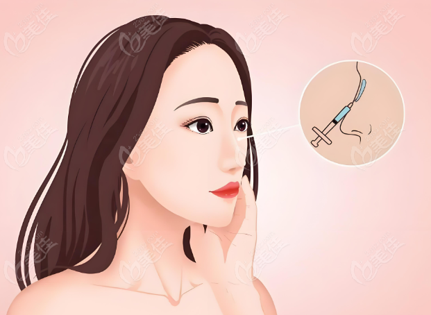 奥美定注射移位扩散