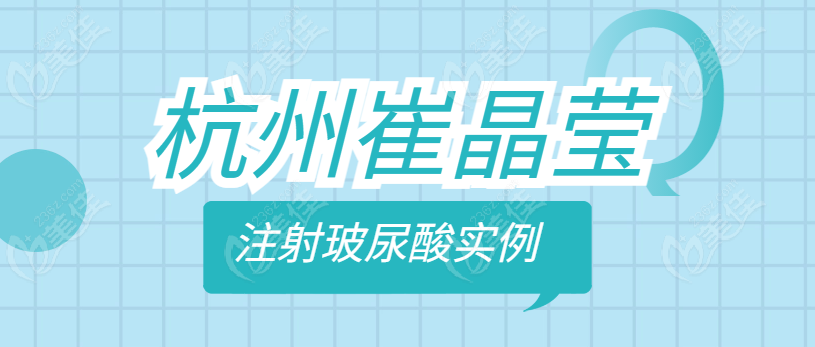杭州崔晶瑩注射玻尿酸實(shí)例