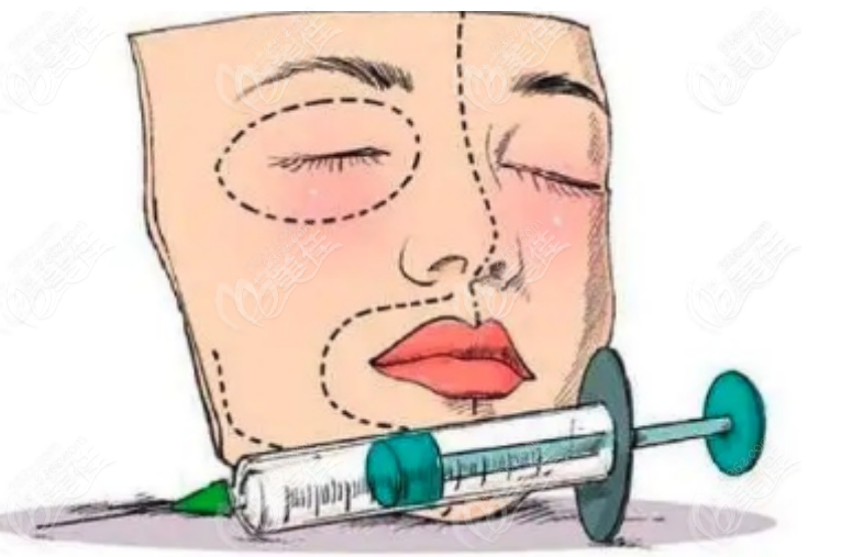 奥美啶注射隆胸取出