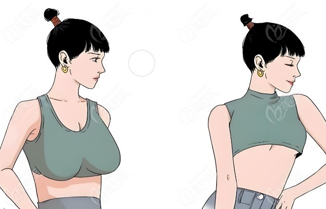 <!--<i data=20240703-sp></i>-->取异物哪里好