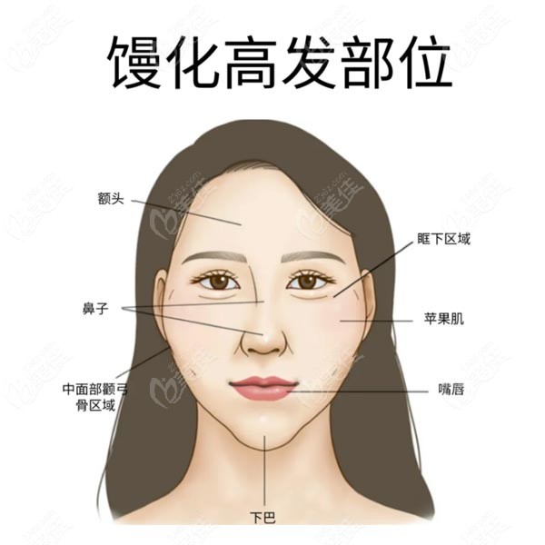面部馒头化容易产生的部位www.236z.com
