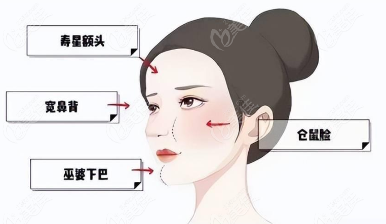 面部馒头化如何变轻薄