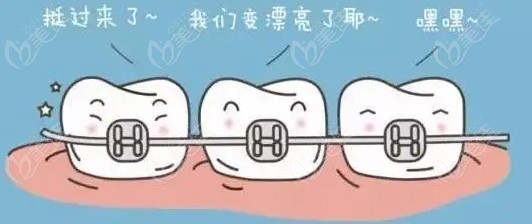 轻微的骨性前突可以用牙套矫正吗