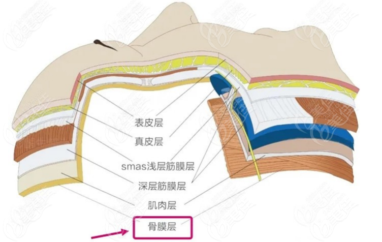 玻尿酸注射手術(shù)