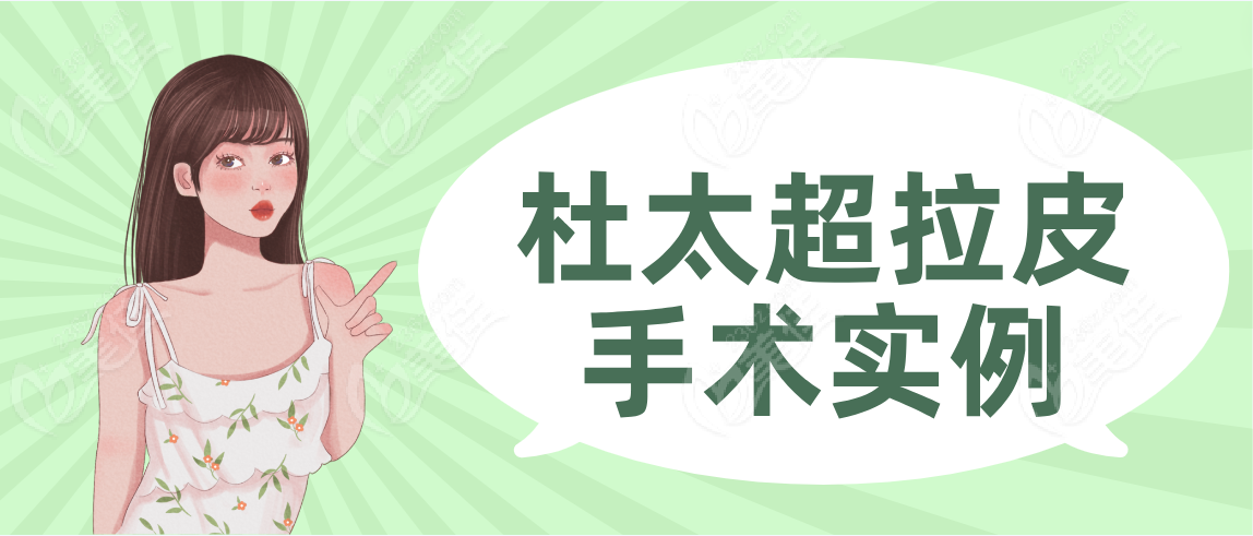 杜太超拉皮手术实例分享