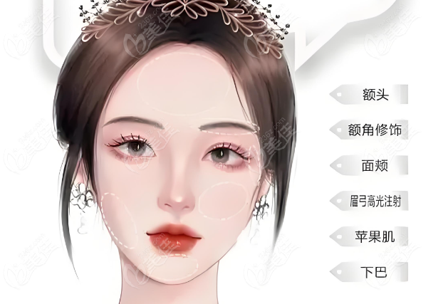 周敏茹整形费用介绍www.236z.com