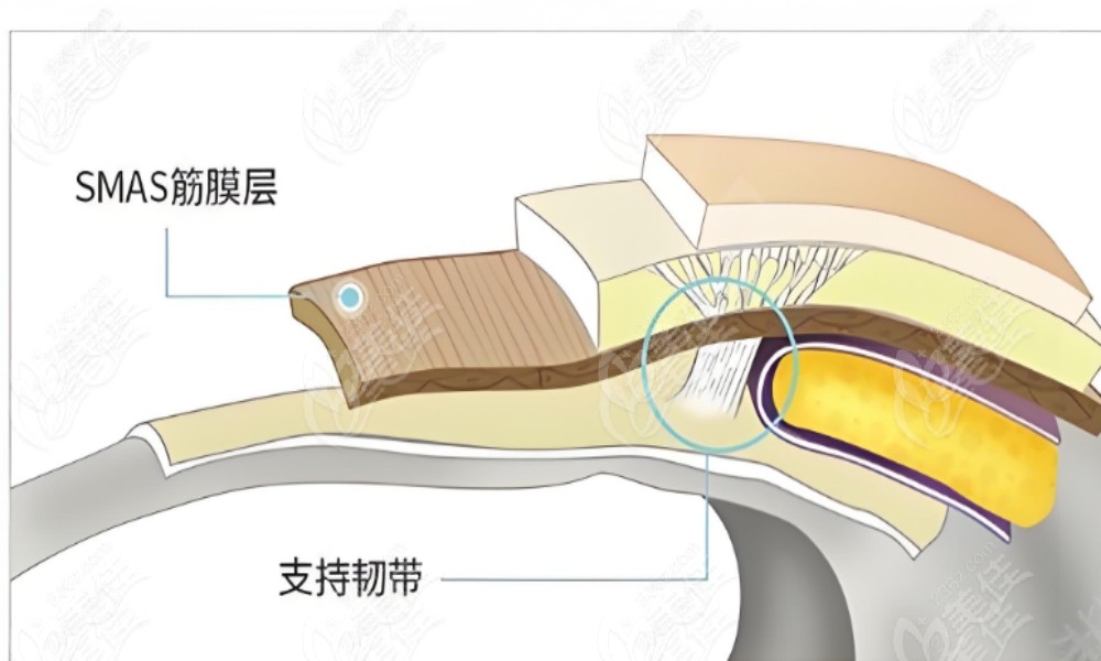 smas面部提升多少钱？