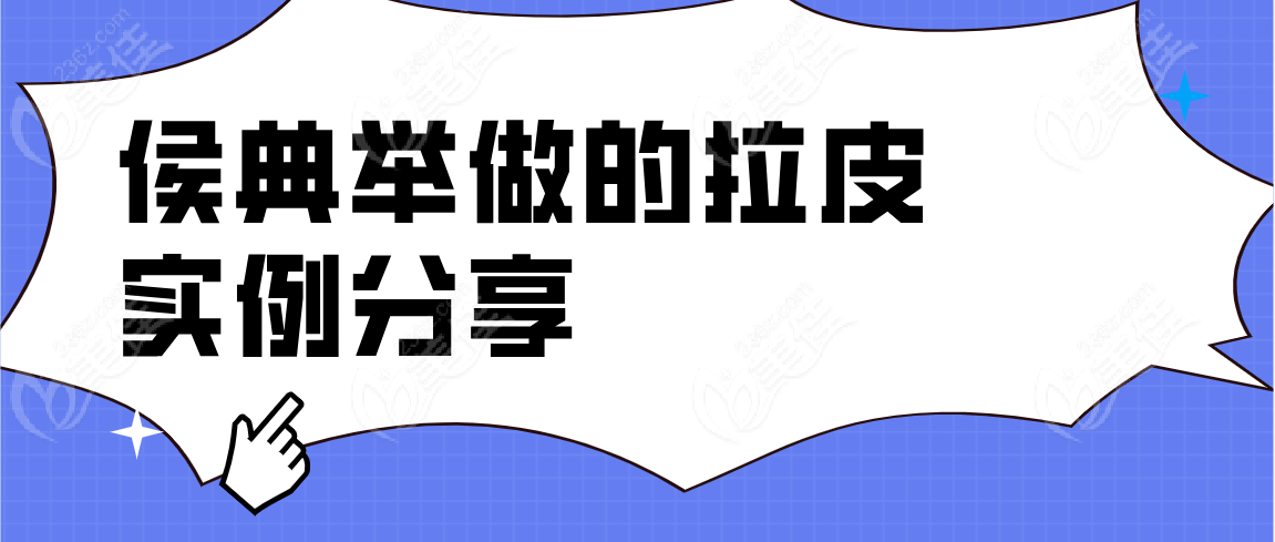 侯典举做的拉皮实例分享