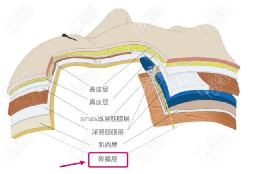 236z.com西安米蘭柏羽玻尿酸注射