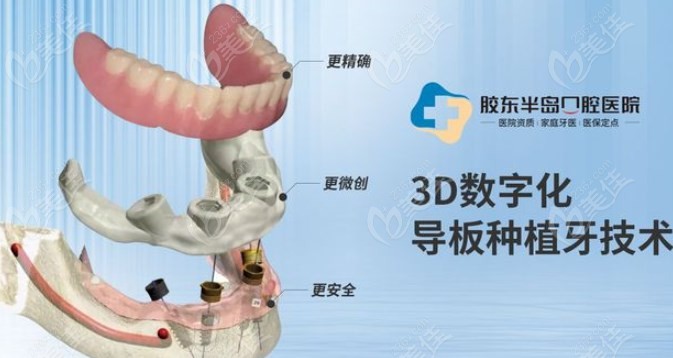 烟台胶东半岛口腔种牙怎么样