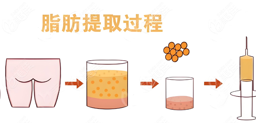脂肪提取过程