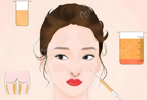 王明利脂肪填充口碑好满意度都挺高的www.236z.com