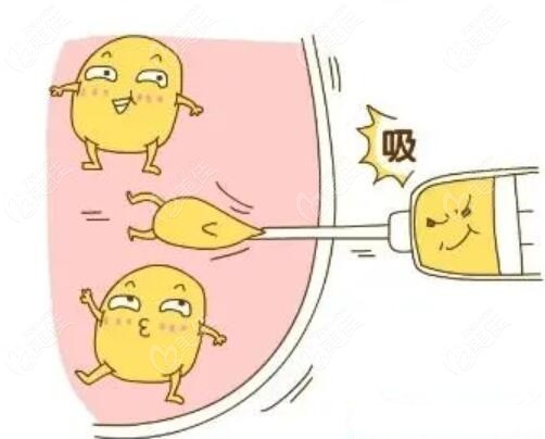 沈阳百嘉丽李衍江吸脂怎么样