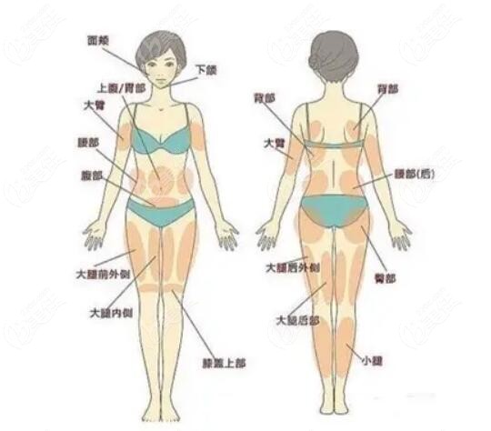 百嘉丽整形李衍江做手臂吸脂的口碑评价