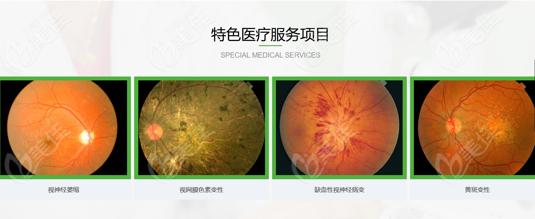 吉林恒达眼科医院治疗视网膜色素变性是真的！