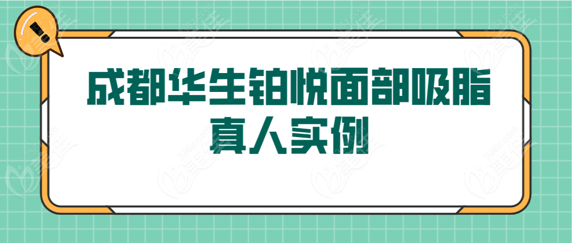 成都华生铂悦面部吸脂真人实例分享