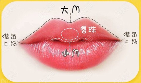 张曼医生做人中缩短和微笑唇整形好