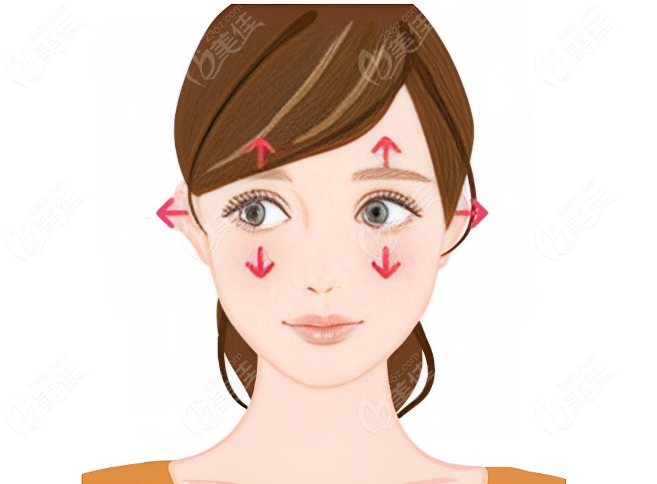 魏志香内眼角修复受损的眼轮匝肌手术实例www.236z.com