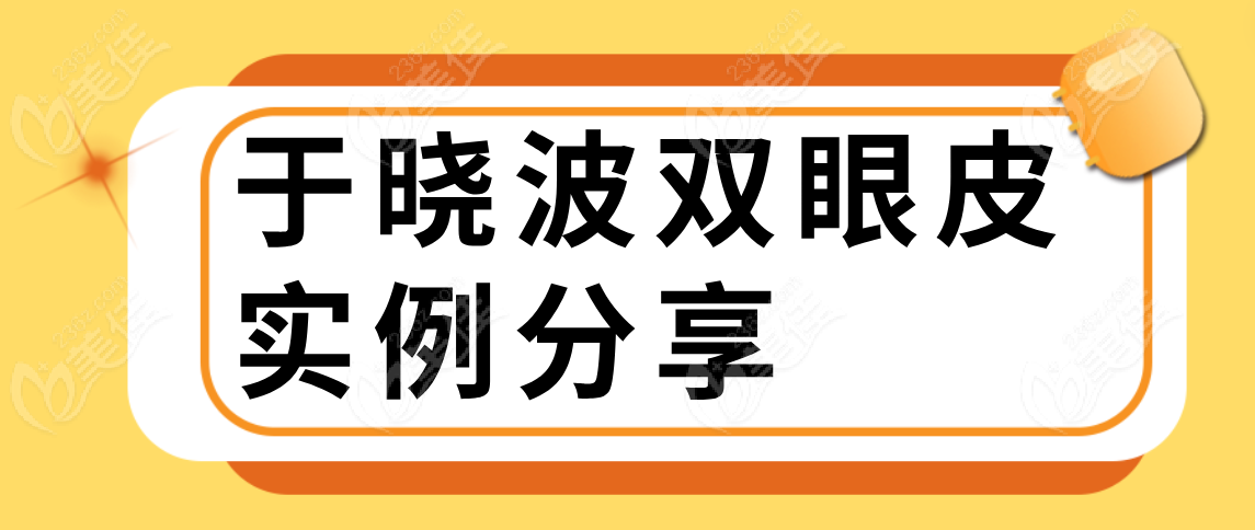 于晓波双眼皮实例分享