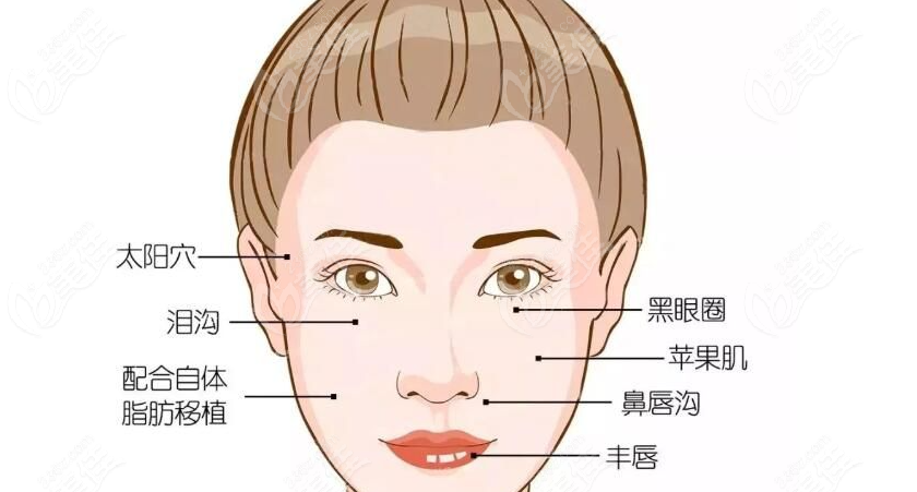 袁玉坤自体脂肪实例