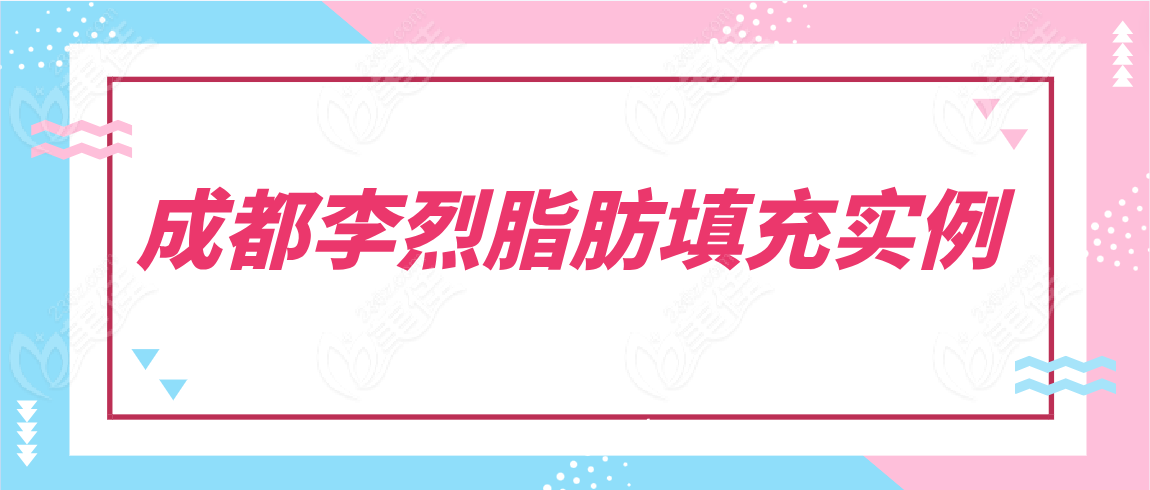 成都李烈脂肪填充实例分享